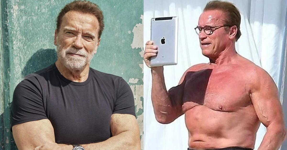 Arnold Schwarzenegger on Hair Loss and Creatine 